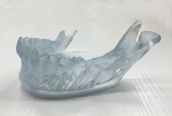 Diş diş parçası